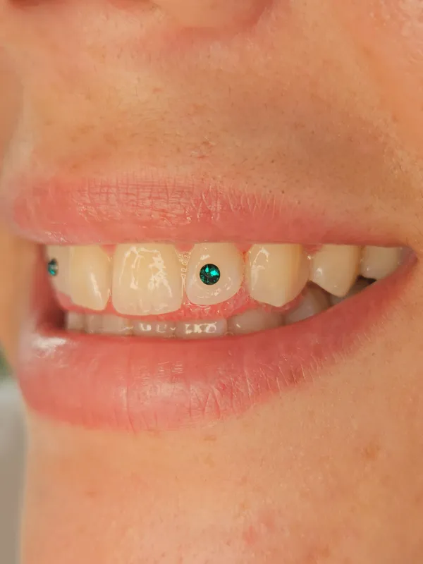 Emerald green crystal tooth gems