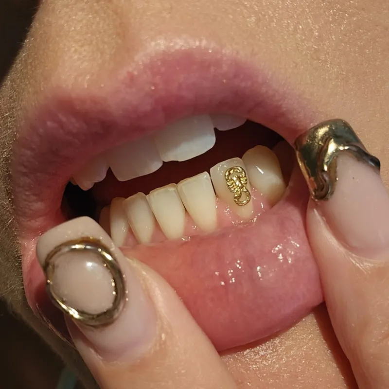 Close-up of gold charm tooth gem
