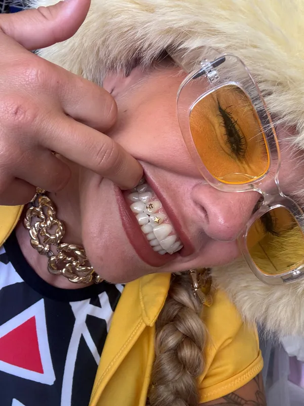 Multiple gold charm tooth gems on smile