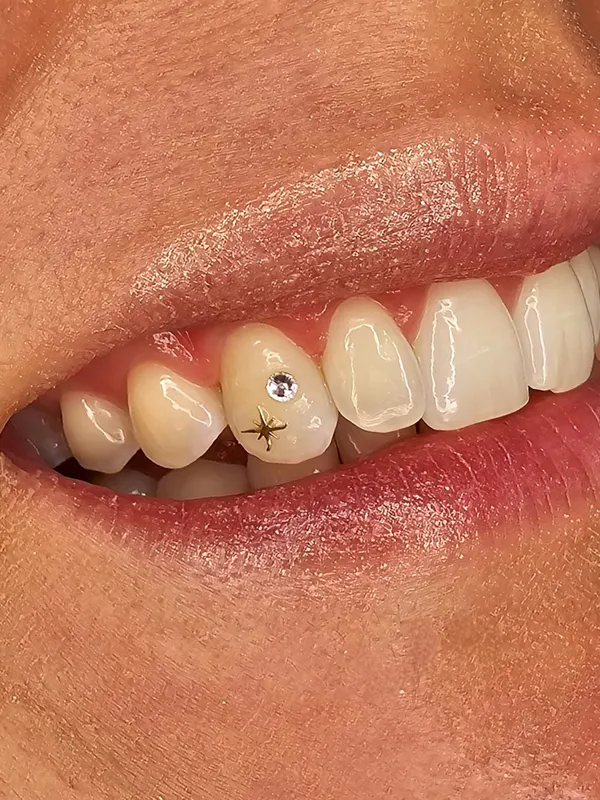 Gold star with crystal tooth gem